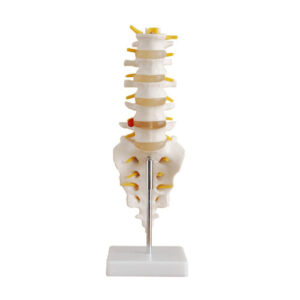 Life-Size Lumbar Vertebrae with Sacrum & Coccyx and Herniated Disc, XC-119, ESMC, Xinch, China