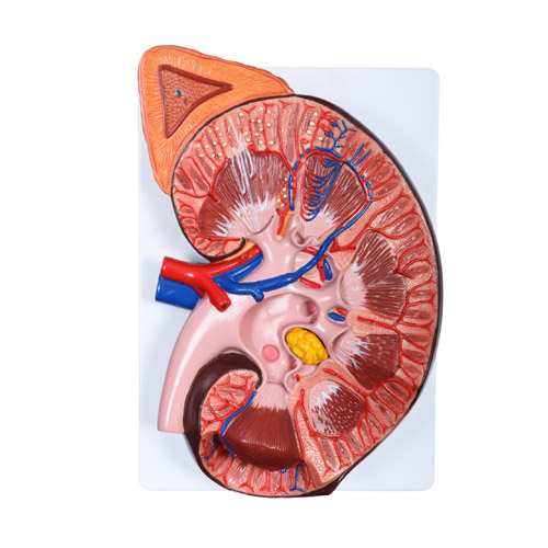Enlarged Kidney Model 1 Part, XC-310-4, ESMC, Xinch, China